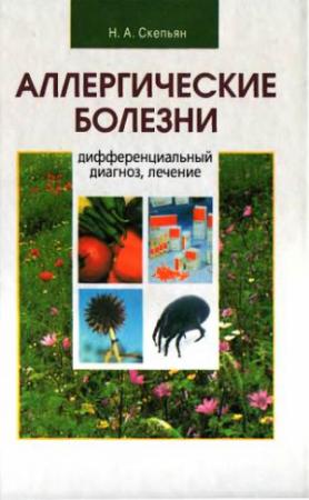Обложка книги «Аллергические болезни: дифференциальный диагноз, лечение» — Николай Скепьян