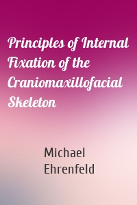 Principles of Internal Fixation of the Craniomaxillofacial Skeleton