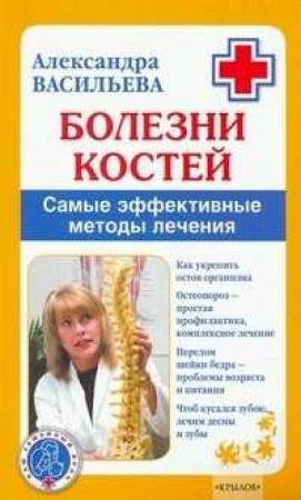 Обложка книги «Болезни костей» — Александра Васильева