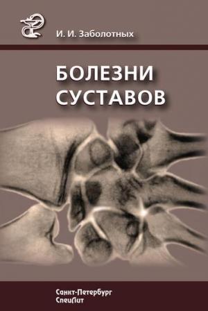 Обложка книги «Болезни суставов» — Инга Заболотных