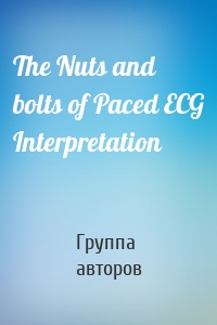 The Nuts and bolts of Paced ECG Interpretation